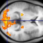 Image of an FMRI scan of the brain for your Expert Witness story