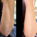 Skin camouflage: a practical intervention for psychological recovery in medicolegal cases